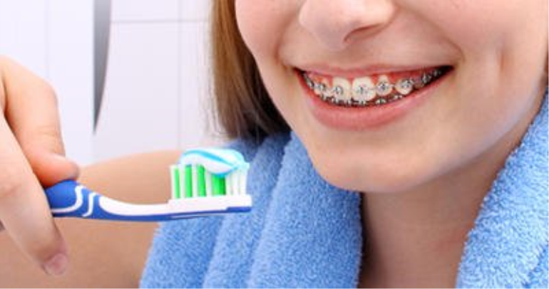 Diş Teli Kullanımında Yapılmaması Gerekenler