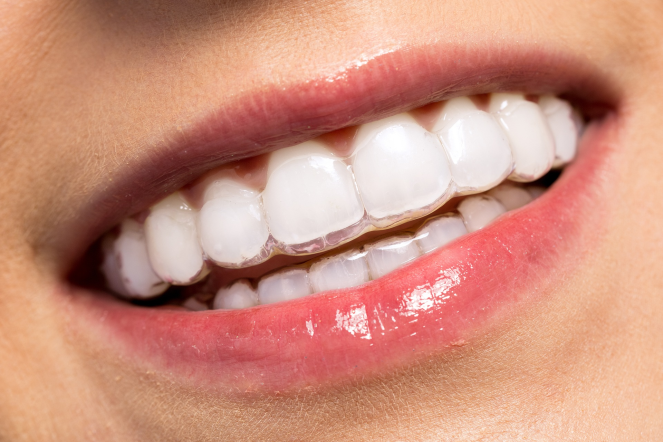 ortodontik tedavi aşamaları