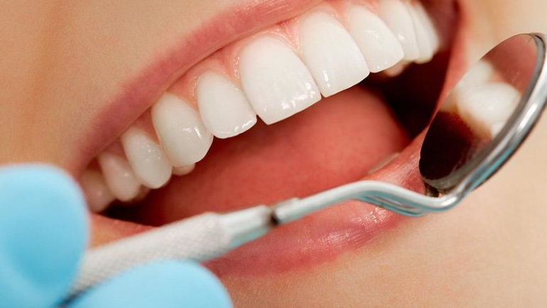Diş Teli Tedavisinde Gerekli Adımlar