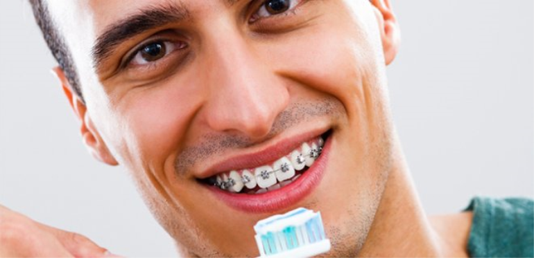 Diş Teli Temizliği Nasıl Yapılmalıdır? 