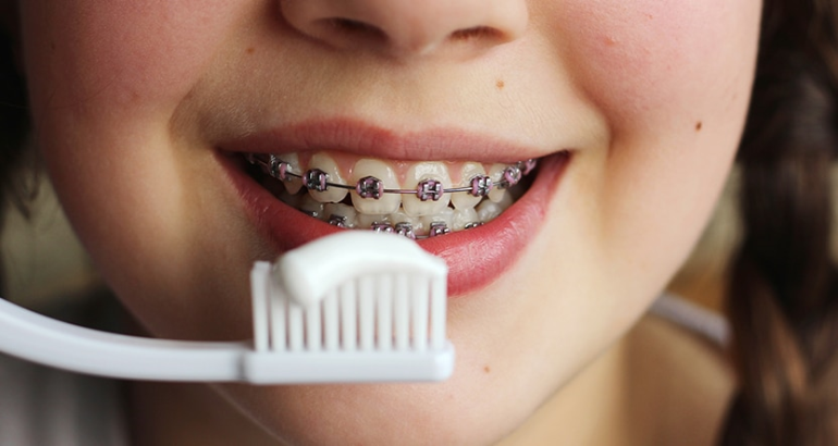 Diş Teli Bakımında Materyal Seçimi