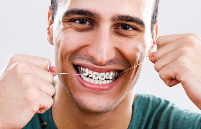 Diş Teli Tedavisi Nasıl Sonuç Gösterir?