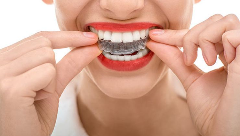 Diş Teli Tedavisinde Gerekli Durumlar