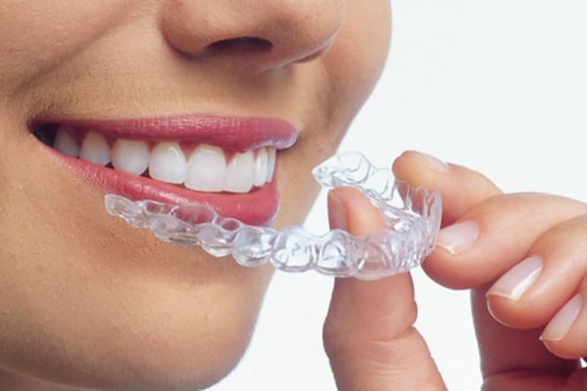 Diş Teli Kullanımı Ardından Plak Kullanılır Mı?