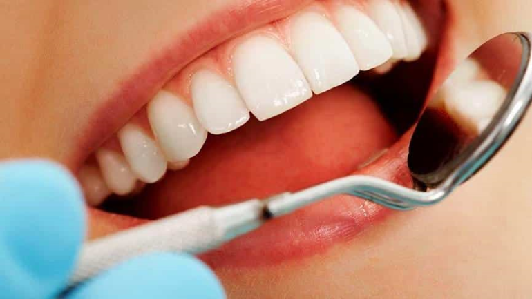 ortodonti aşamaları