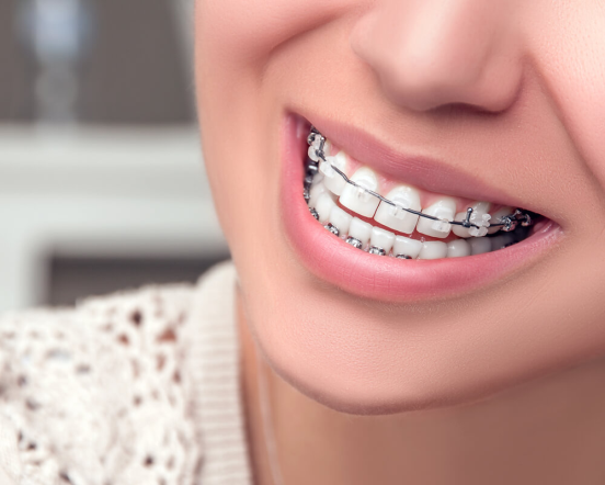ortodonti fiyatlari