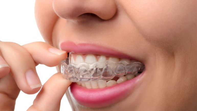 Diş Plakları Neden Kullanılır?