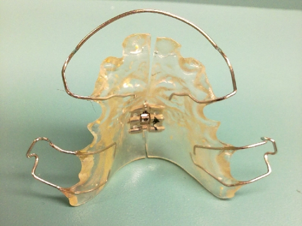 ortodonti apareyler