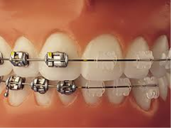 ortodonti fiyat değerleri
