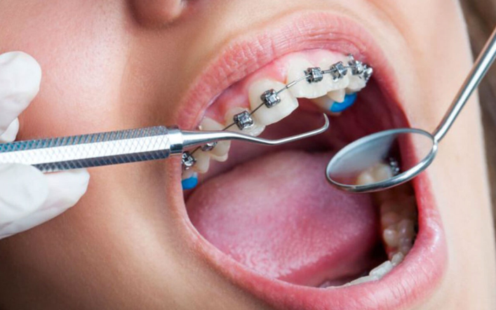 ortodonti sağlığı