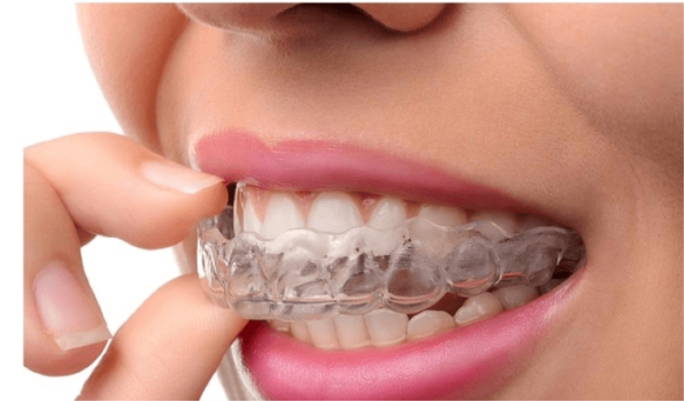 Ortodontist Nasıl Seçilir?