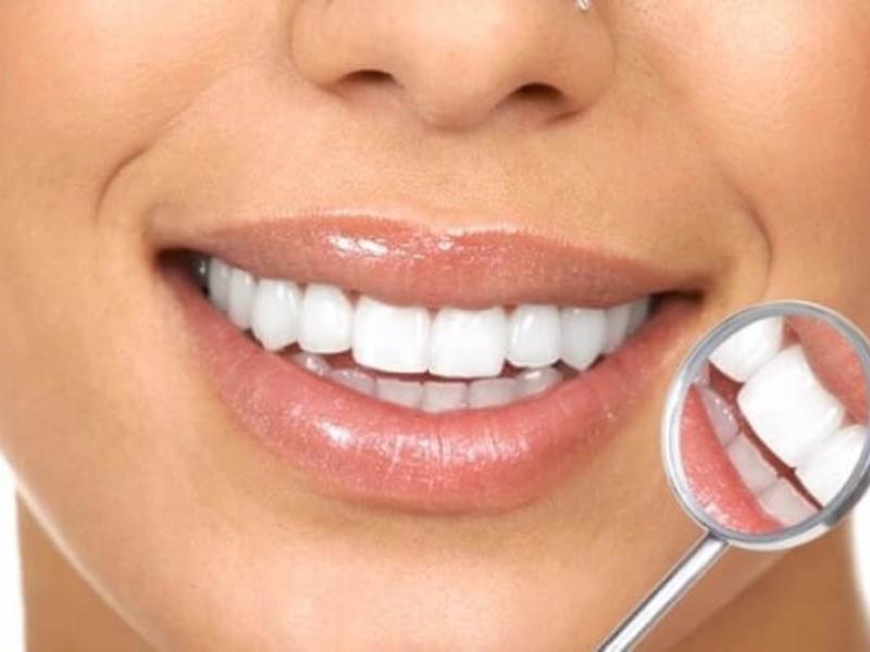 Alpdent ile Sağlıklı Gülümseme