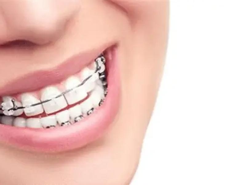 Covid 19 Sürecinde Dişteli Kullanımı