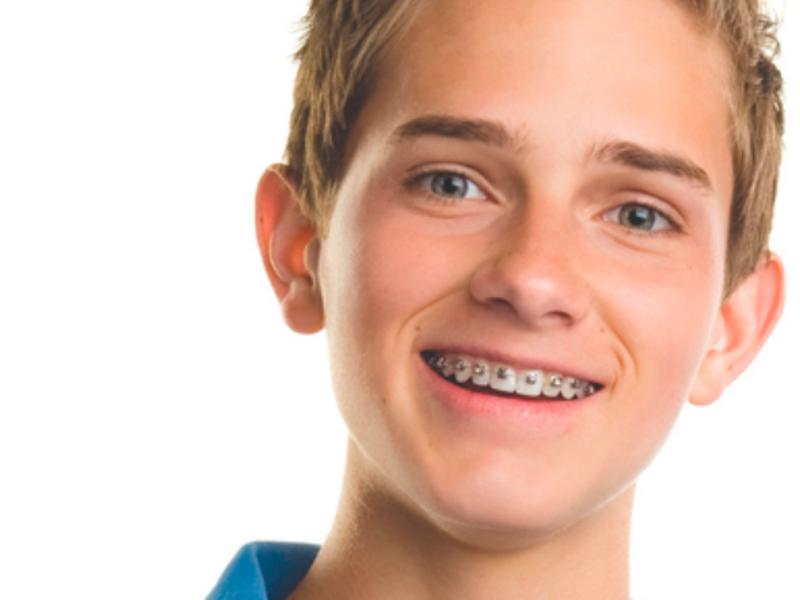 Diş teli için en doğru yaş