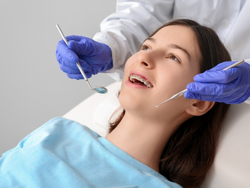 Diş Teli Takıldıktan Sonra Dişler Ne Zaman Düzelmeye Başlar?